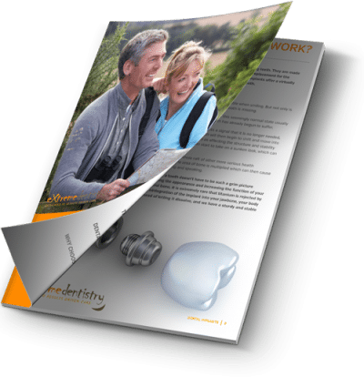 Dental implants guide and information