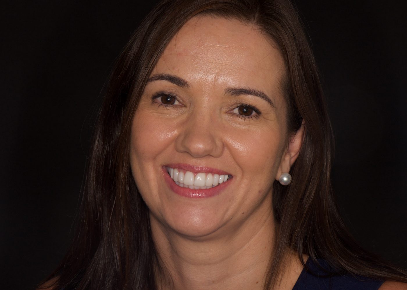 The Million Dollar Smile - After