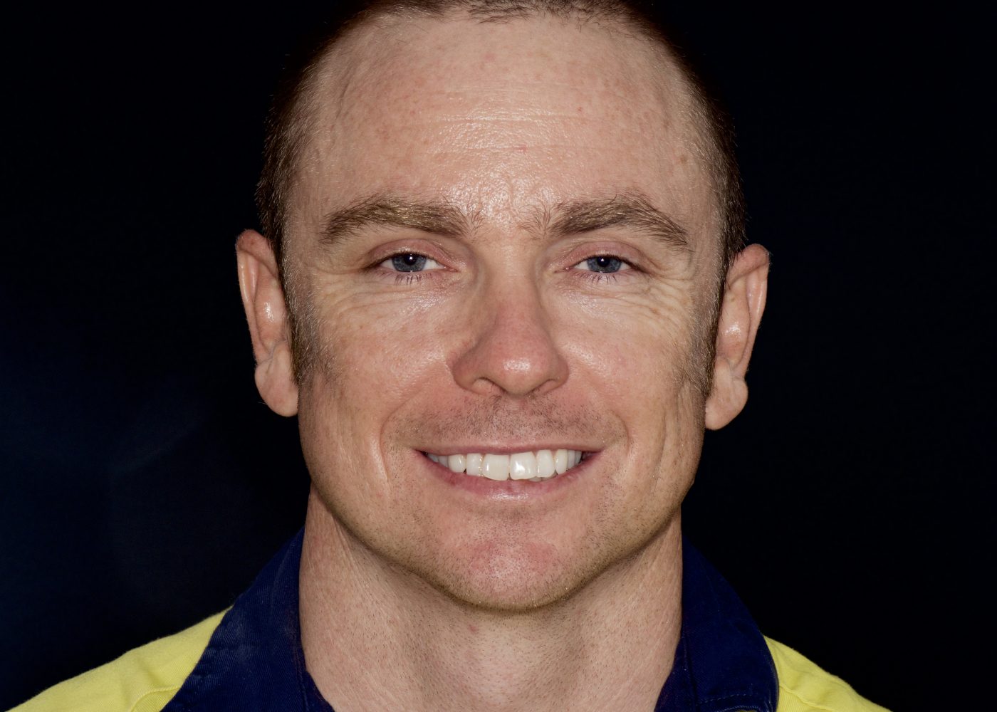 Implant-Supported Restoration - Before