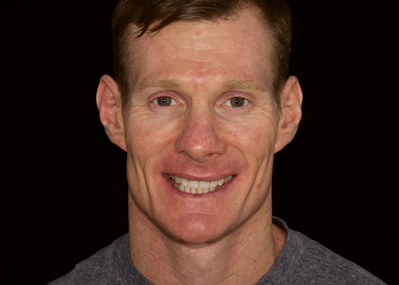 Alignment and Whitening - After