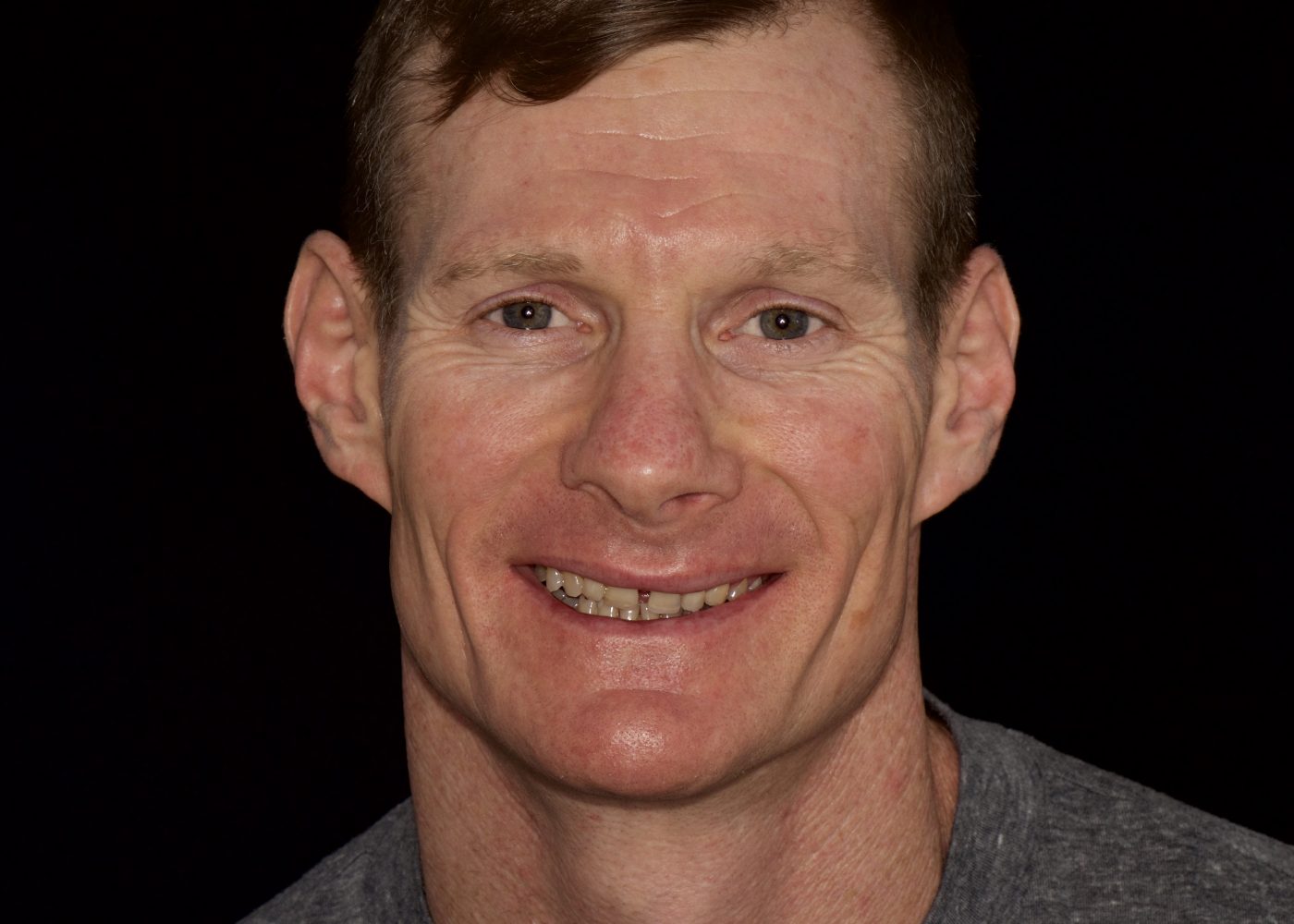 Alignment and Whitening - Before